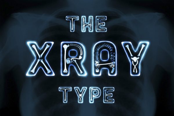 x射线医学透视骨骼效果装饰字体 The X-Ray Type